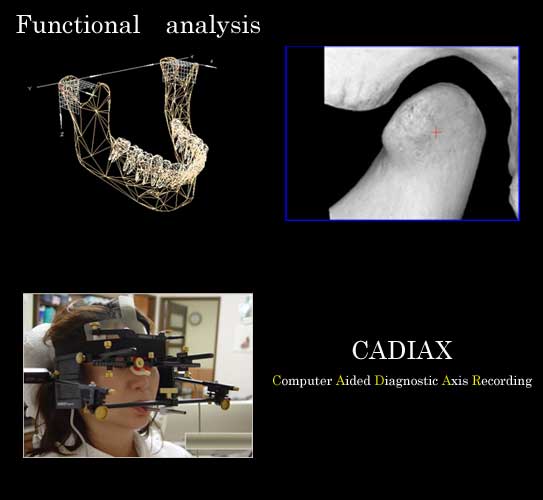 CADIAX,Computer Aided Diagnostic Axis Recording