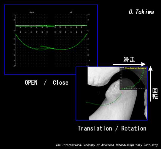 Translation / Rotation