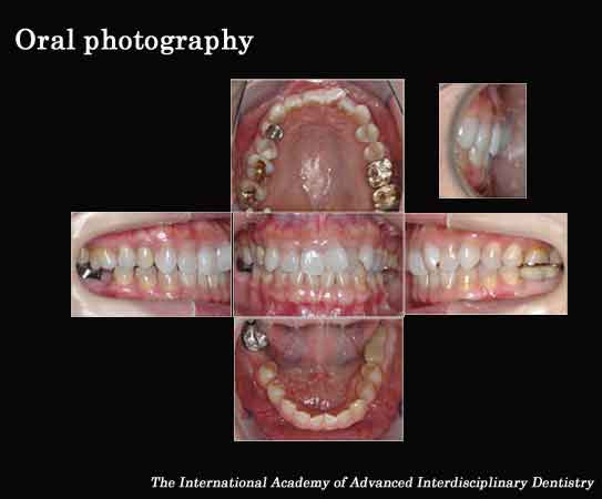Oral Photography