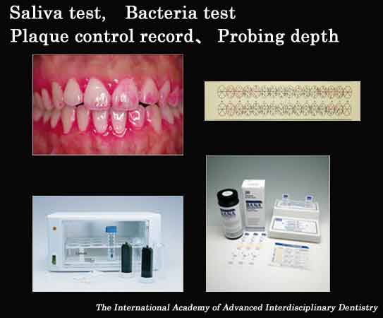 Saliva test,Bacteria test,Plaque control record,Probing depth